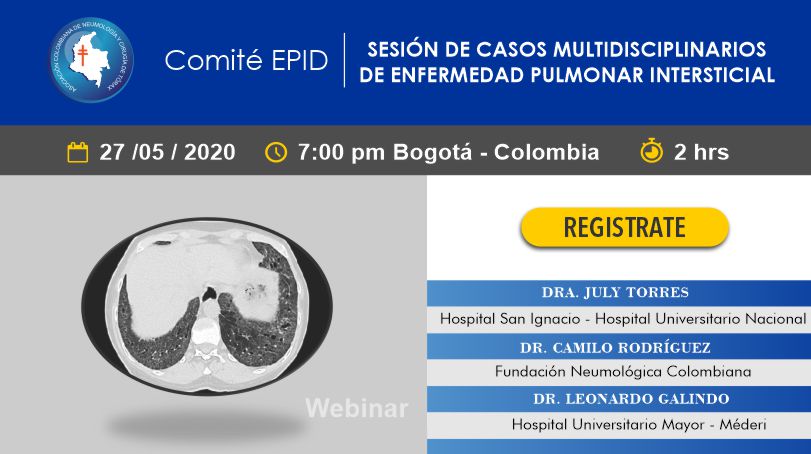 SESIÓN DE CASOS MULTIDISCIPLINARIOS DE ENFERMEDAD PULMONAR INTERSTICIAL
