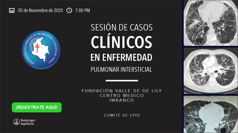 🔴#WEBINAR:  “ SESIÓN DE CASOS CLINICOS EN ENFERMEDAD PULMONAR INTERSTICIAL” – Comité de EPID